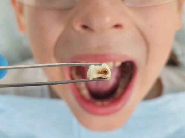 Best Emergency Treatment for Toothache in Williams, AZ